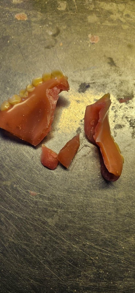 Prothese die gerepareerd kan worden, spoedreparatie in eigen lab